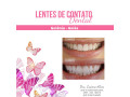 facetas-porcelana-goiania-goias-small-2