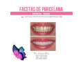 facetas-porcelana-goiania-goias-small-3